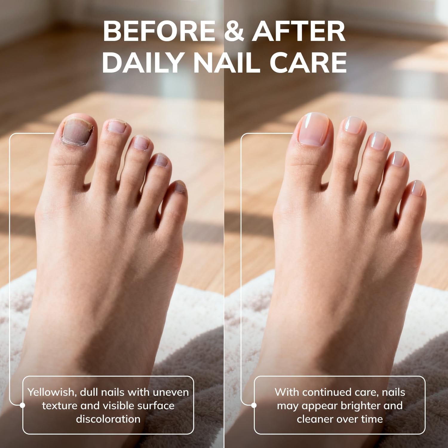 Swissklip KlearNail Toenail Stick | Medi-Care Treatment 0.3 Fl Oz (Pack of 1)