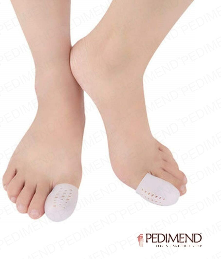 Toe Cover Caps To Prevent Ingrown Toenail, Blisters, Calluses Bunion Protector