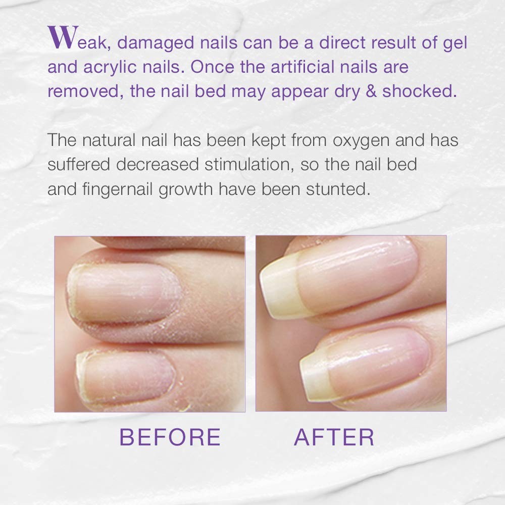 Nail Tek Xtra 4, Nail Strengthener for Weak, Severely Damaged Nails