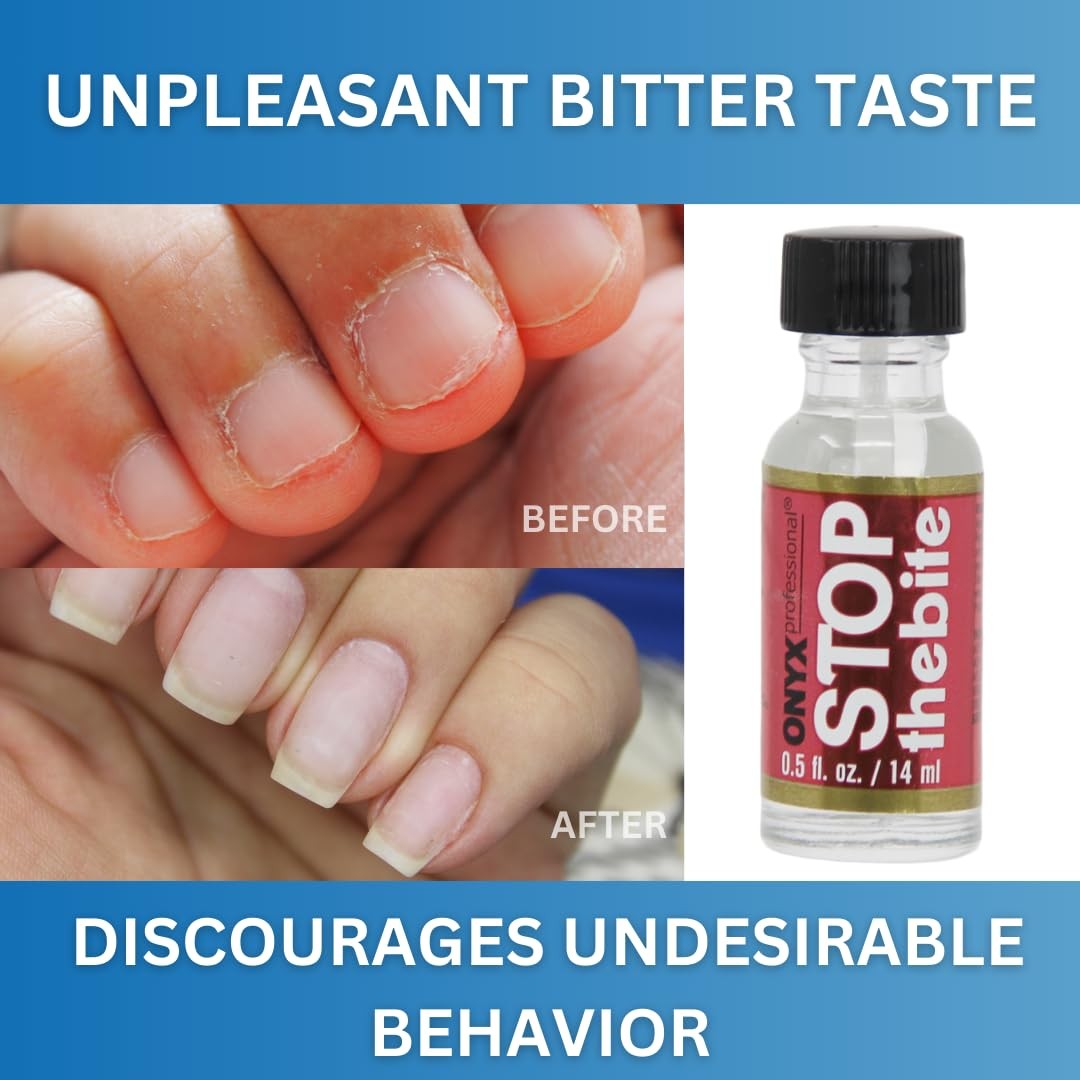 Onyx Professional Stop the Bite Nail Biting Prevention 0.5 Fl Oz (Pack of 1)