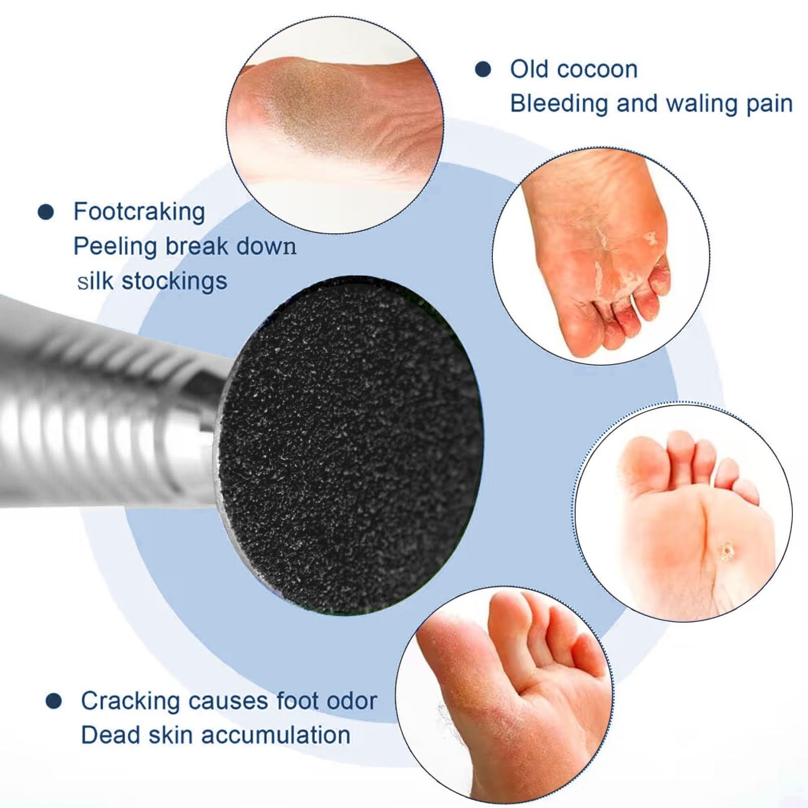 100pcs Foot File Sandpaper Disc with 1 Metal Shaft Replaceable Sanding Pads f…