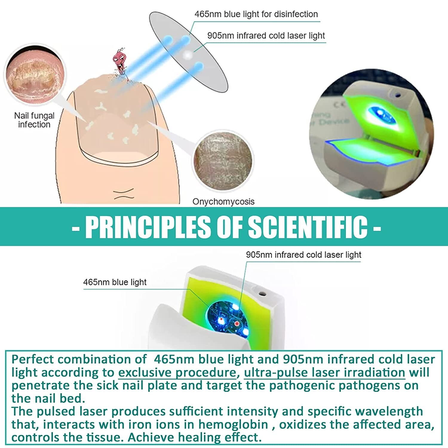 Antifungal Nail Fungus Treatment Blue Light Therapy Device Remove Fungal Fungi