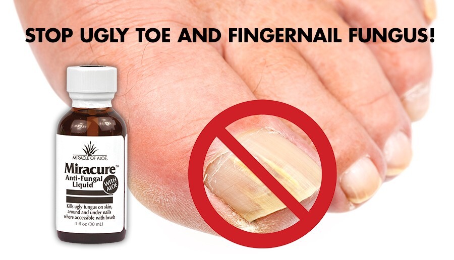 Miracure Anti-Fungal Treatment 1 ounce bottle with 10 Toe Separators and Brush
