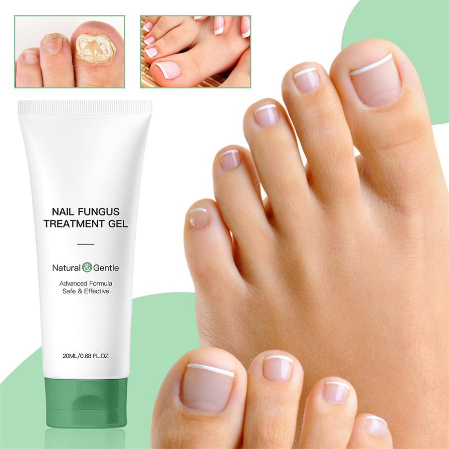 Nutraboost Nail Fungus Treatment Gel, Nail Fungus, Fungus Cream 2025 NEW （1PC）