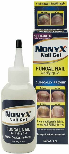 NonyX Nail Gel Treatment. 4oz 6 month supply USA Seller NEW STOCK FREE SHIP