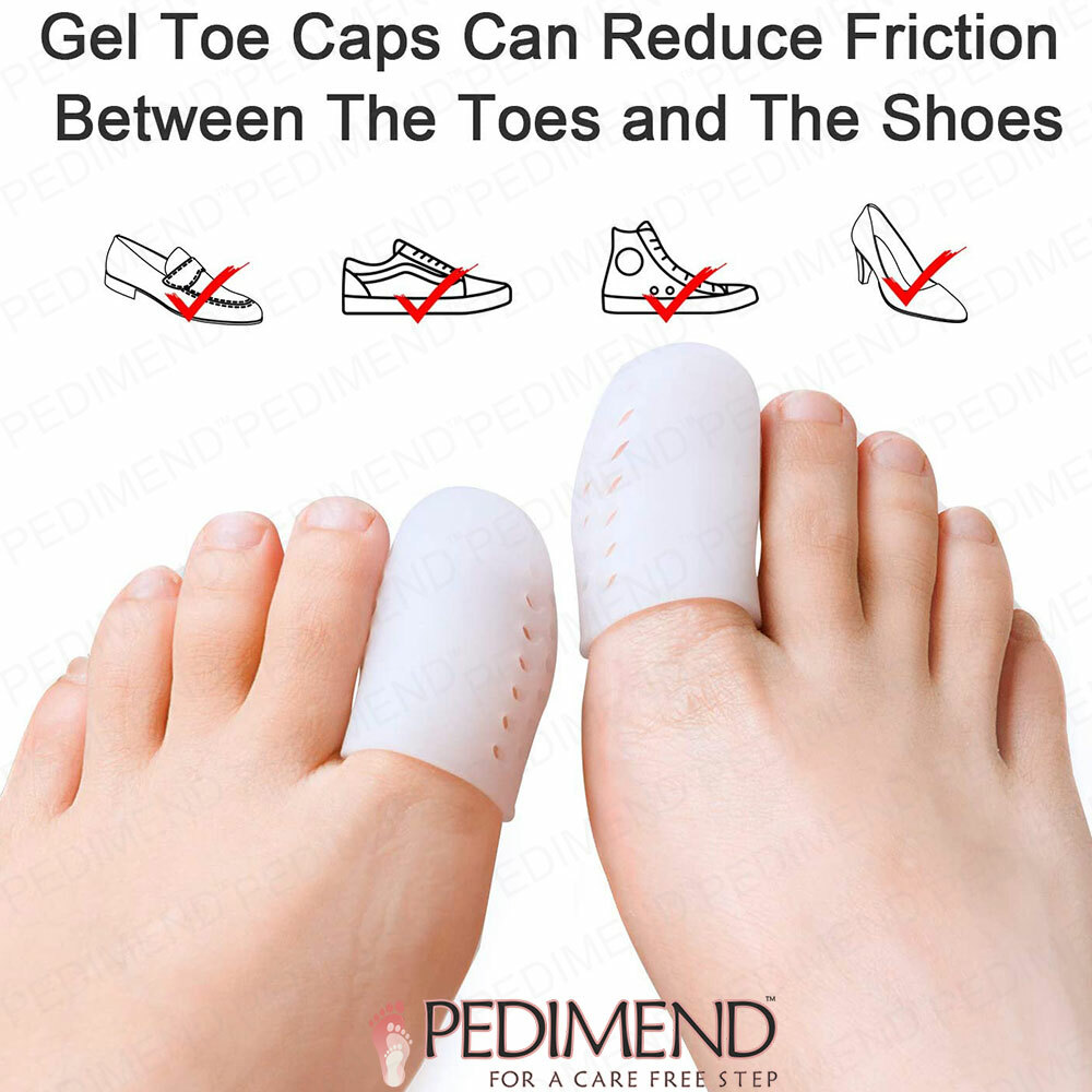 Toe Cover Caps To Prevent Ingrown Toenail, Blisters, Calluses Bunion Protector