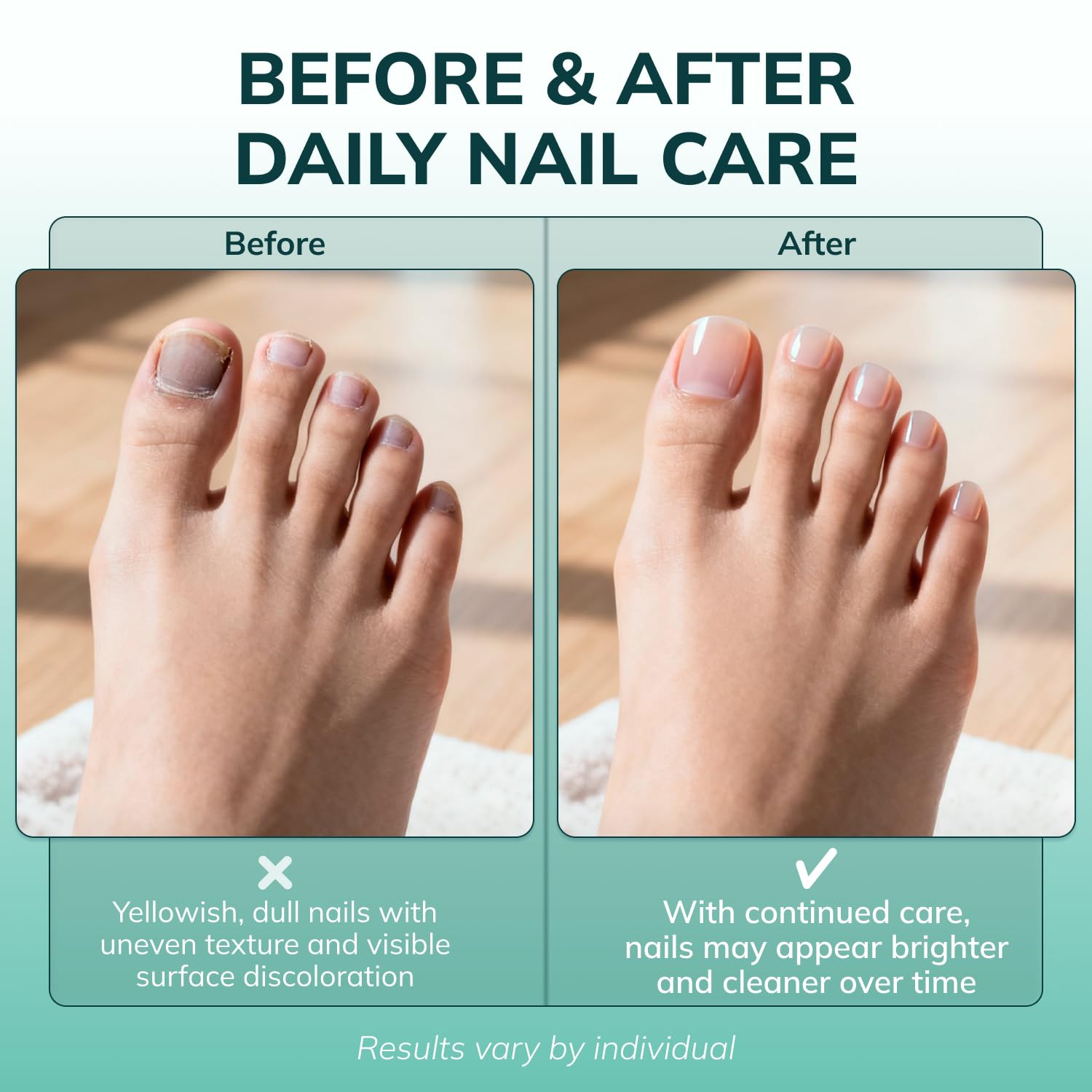 Swissklip Klearnail Toenail Stick | Medi-Care Treatment | Natural Solution for H