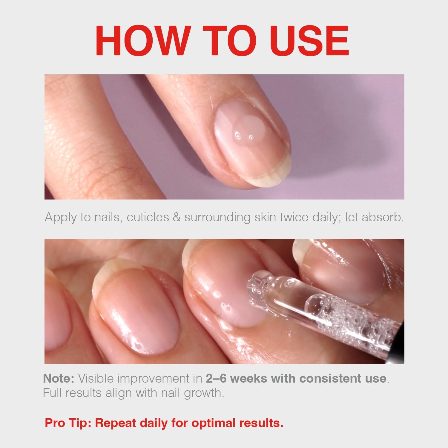 Probelle Natural Fungal Nail Oil, Color 0.5 Fl Oz (Pack of 1), Clear