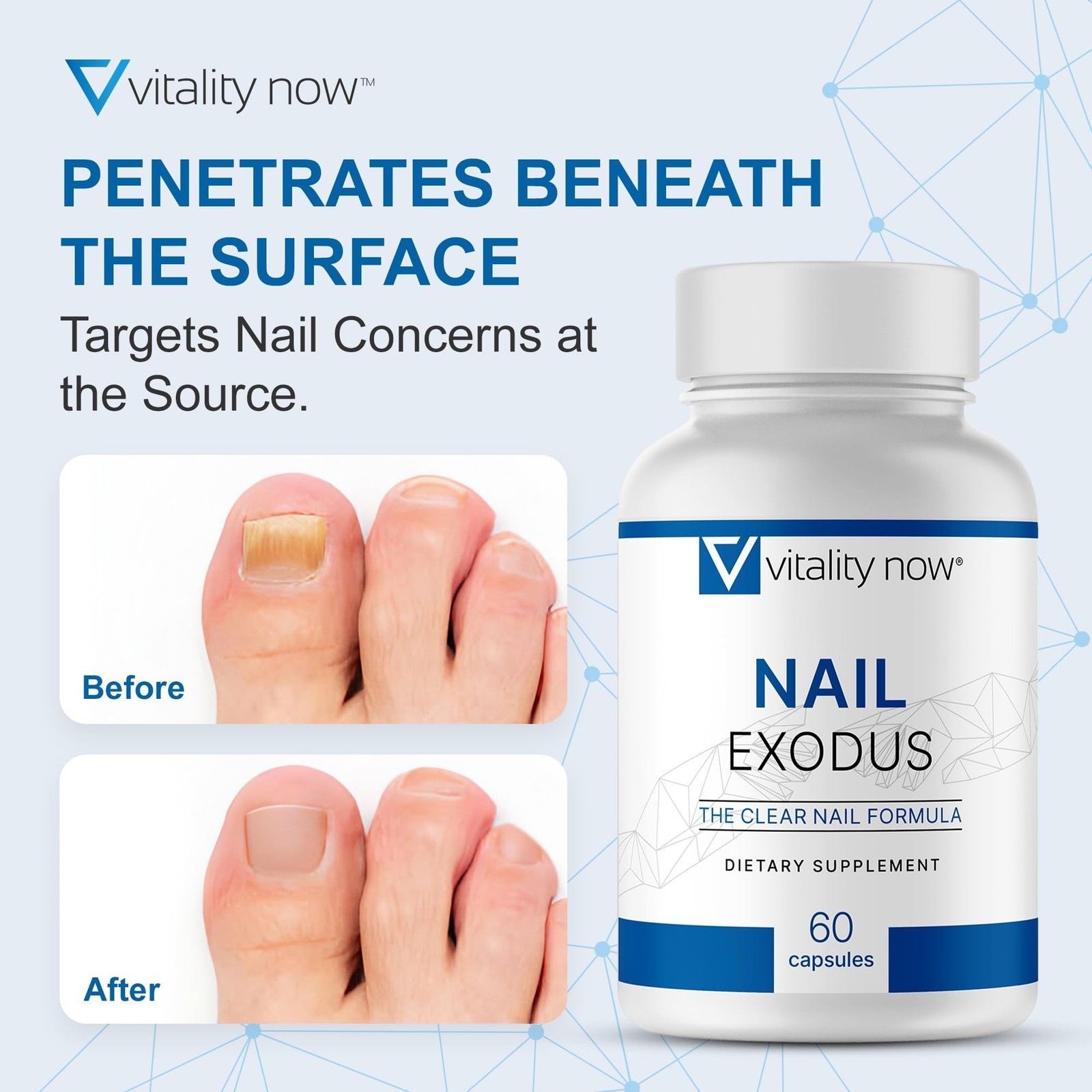 Nail Exodus – Vitality Healthy Nails – Premium Formula for Healthier Feet – 6…