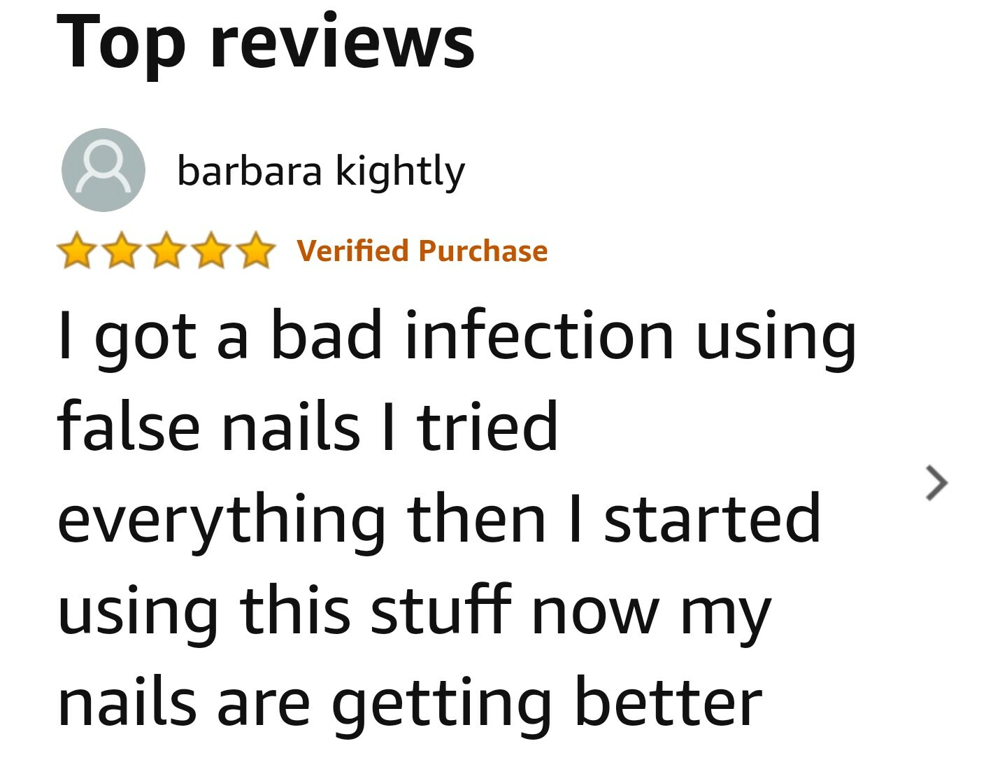 Anti Fungal Treatment NAIL FUNGUS ZAP Natural Toe Nail Fungus Infection UK 20ML