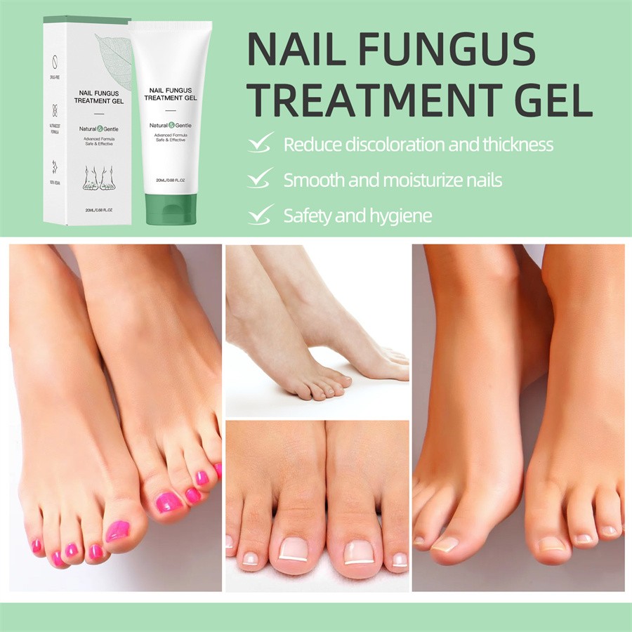 Nutraboost Nail Fungus Treatment Gel, Natural Nail Repair Strengthening Gel