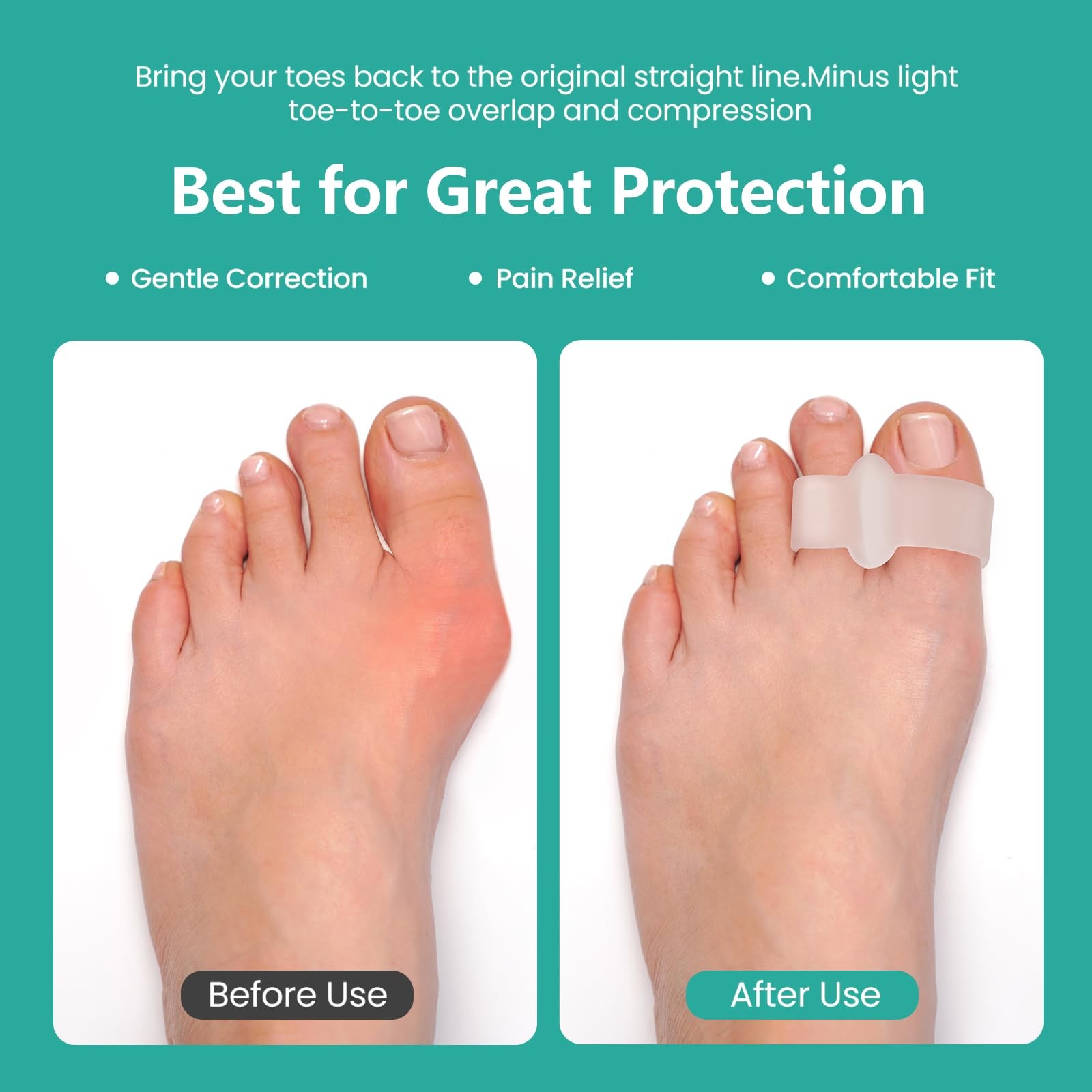 Welnove Pack of 12 Bunion Corrector, Toe Separators with large, Multi Colour