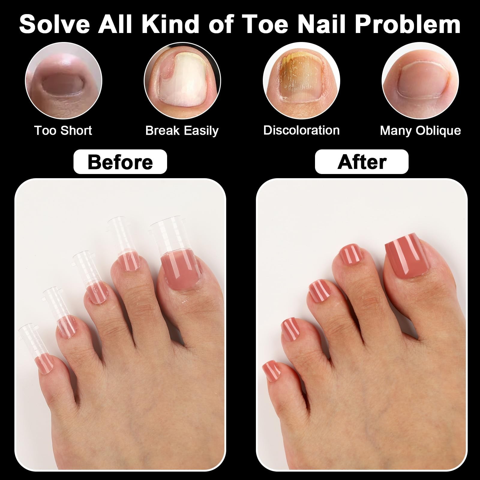 ASONRL 160 Pcs Toe Nail Forms 16 Sizes
