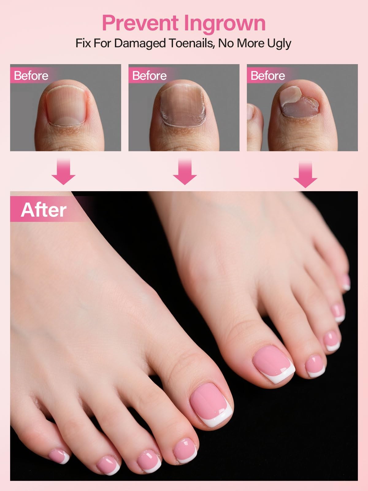 Press On Toenails French Tips, 150 Pieces Short Toe Nail Tips
