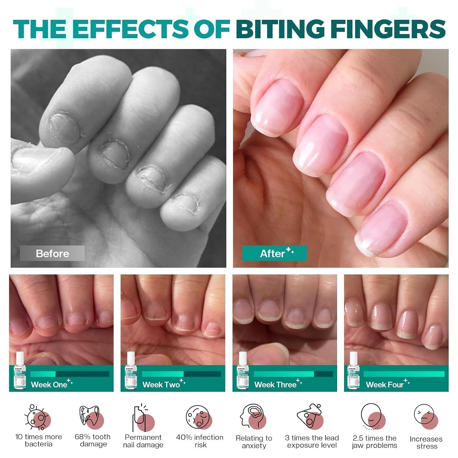 Nail Biting Prevention For Kids: Thumb Sucking Deterrent No Bite Nail Polish …