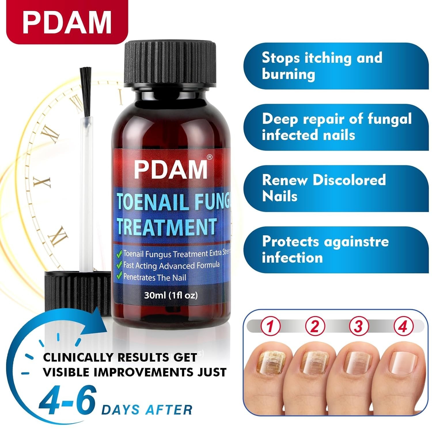 PDAM Toenail Fungus Treatment Extra Strength 1 Fl Oz/30ml 7 DAYS REMEDY Fast-Act