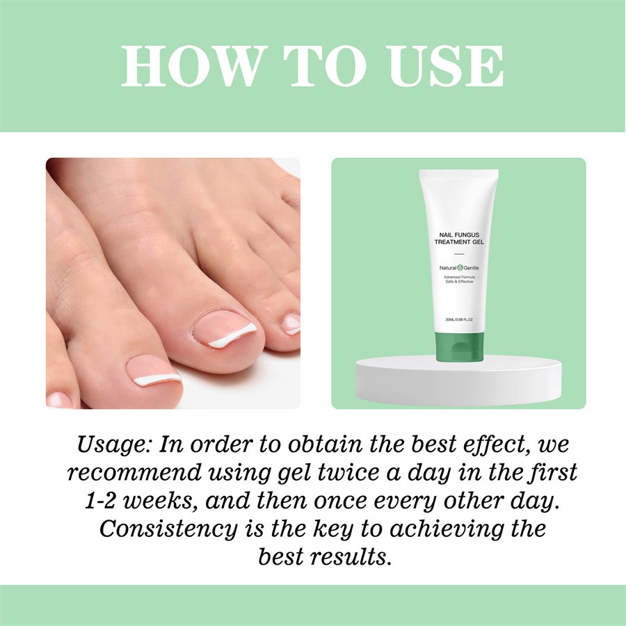 Nutraboost Nail Fungus Treatment Gel, Nail Fungus, Fungus Cream 2025 NEW （1PC）