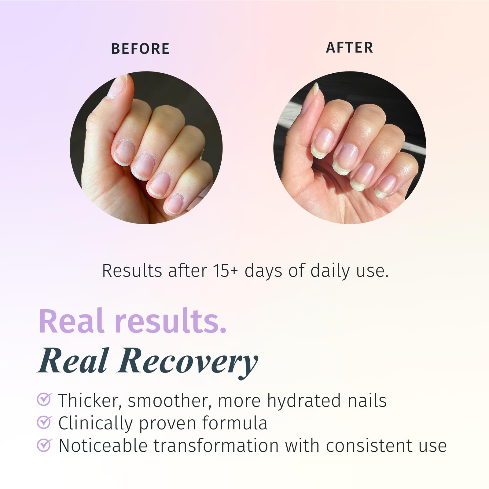 Duri Rejuvacote 2 Nail Growth Base and Top Coat, Balanced Repair – Nail Harde…
