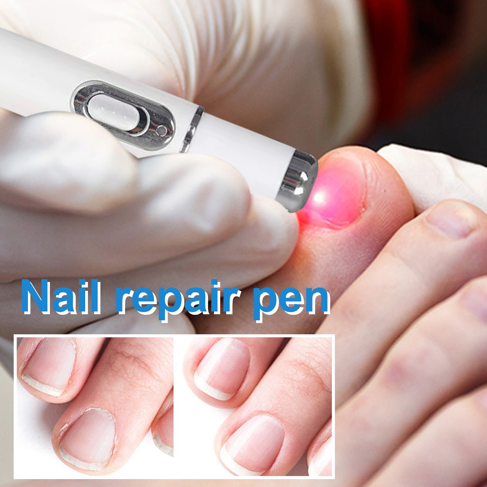 Nail Repair Pen Blue Light Fingernail Revive Pen Fingernail Repairing Device