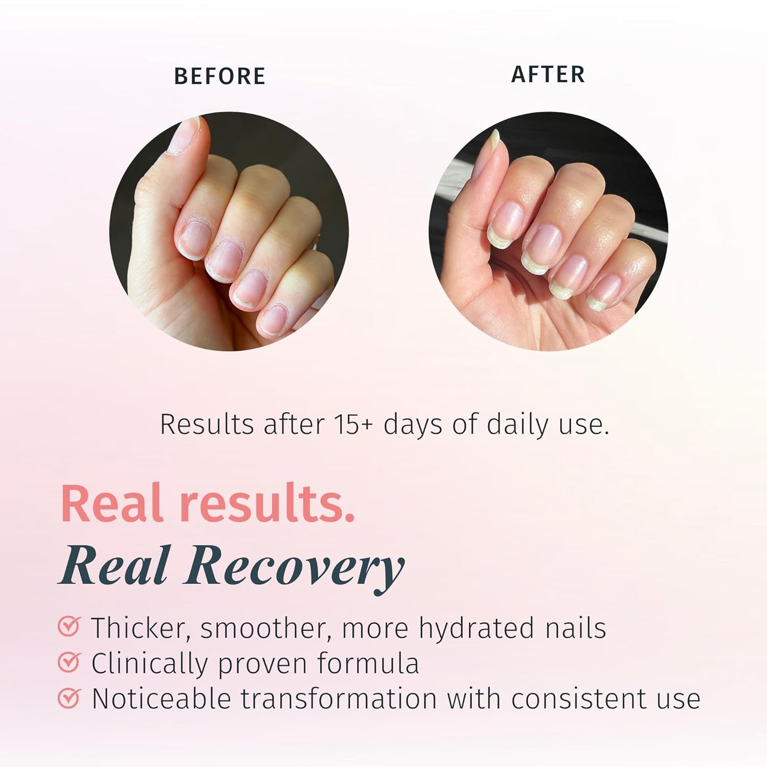 0.45 Fl Oz (Pack of 1), Rejuvacote 1 Original Maximum Strength Nail Growth…