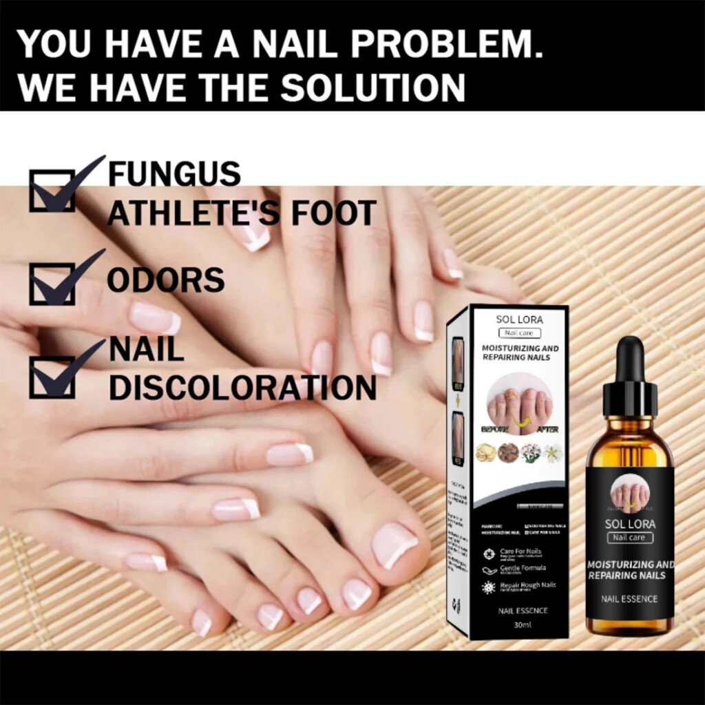 SOLLORA Nail essence Gray nail repair solution Nail Fungus beautify nails