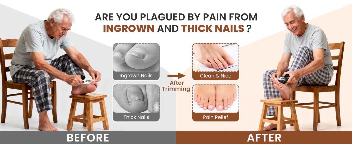 Ingrown Toenail Removal Kit: 8 Pcs Professional Toenail Clippers for Thick