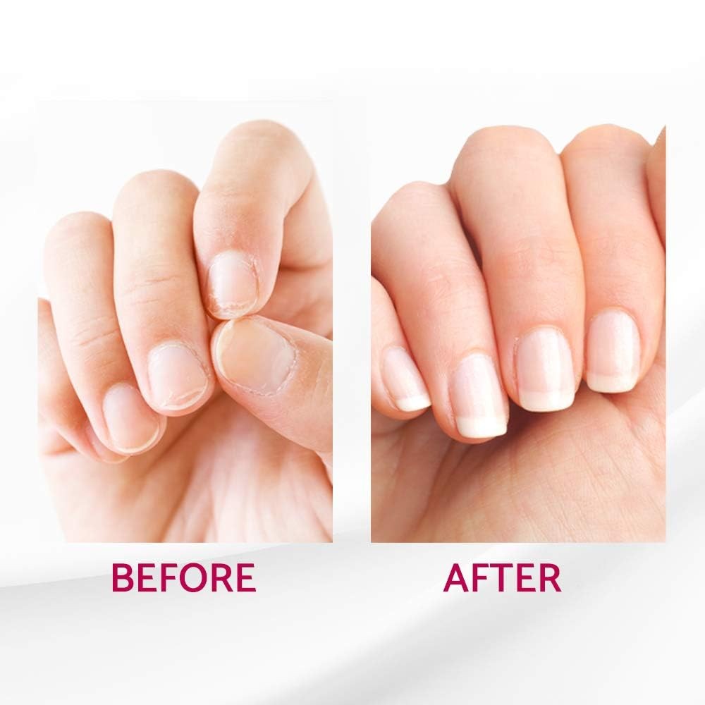 IBD Reconstrux Nail Repair Treatment – 0.12 Fl Oz (Pack of 1), Clear