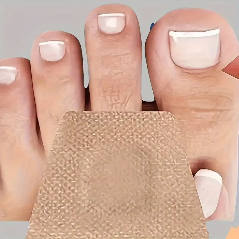 36pcs Nail Care Patches, Quick Repair for Damaged and Discolored Nails, Gentle