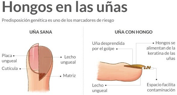 ORIUNDO natural life / Nail Fungus Away (Quita Hongos para Uñas)