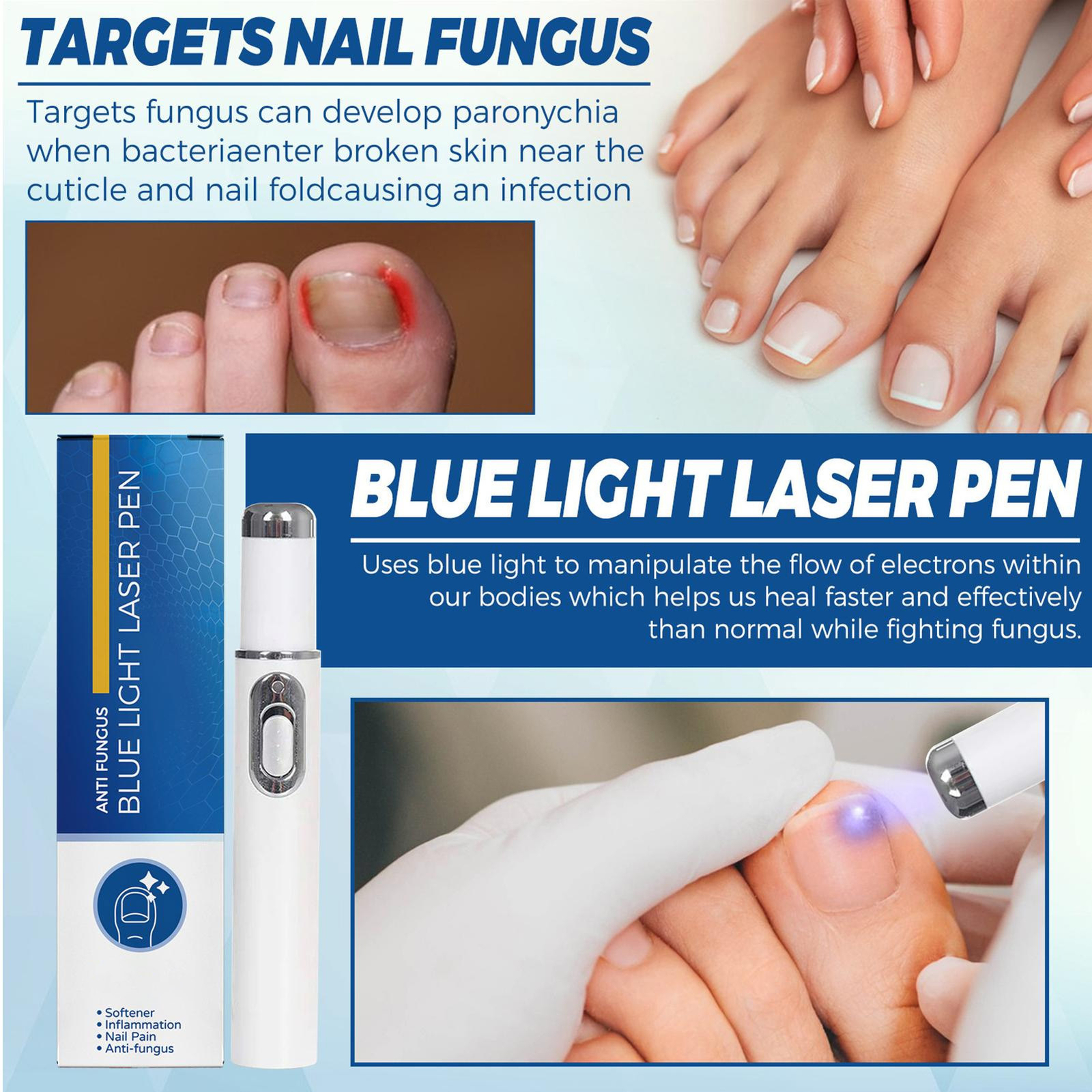 Nail Repair Pen Blue Light Fingernail Revive Pen Fingernail Repairing Device