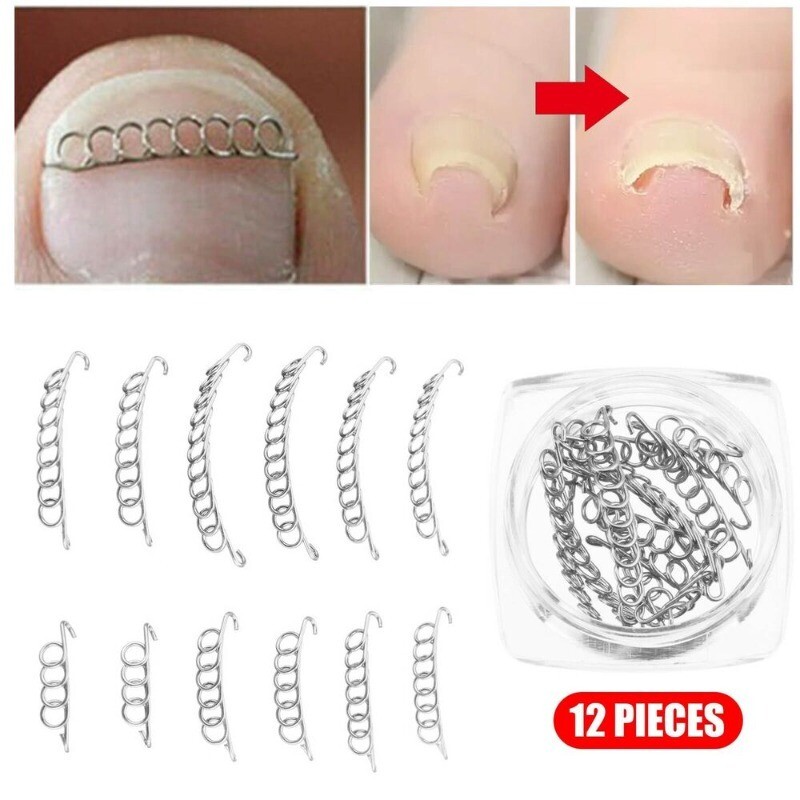 Toenail Correction Tool 12pcs/set Ingrown Toe Nail Fixer Pedicure 2024 NEW