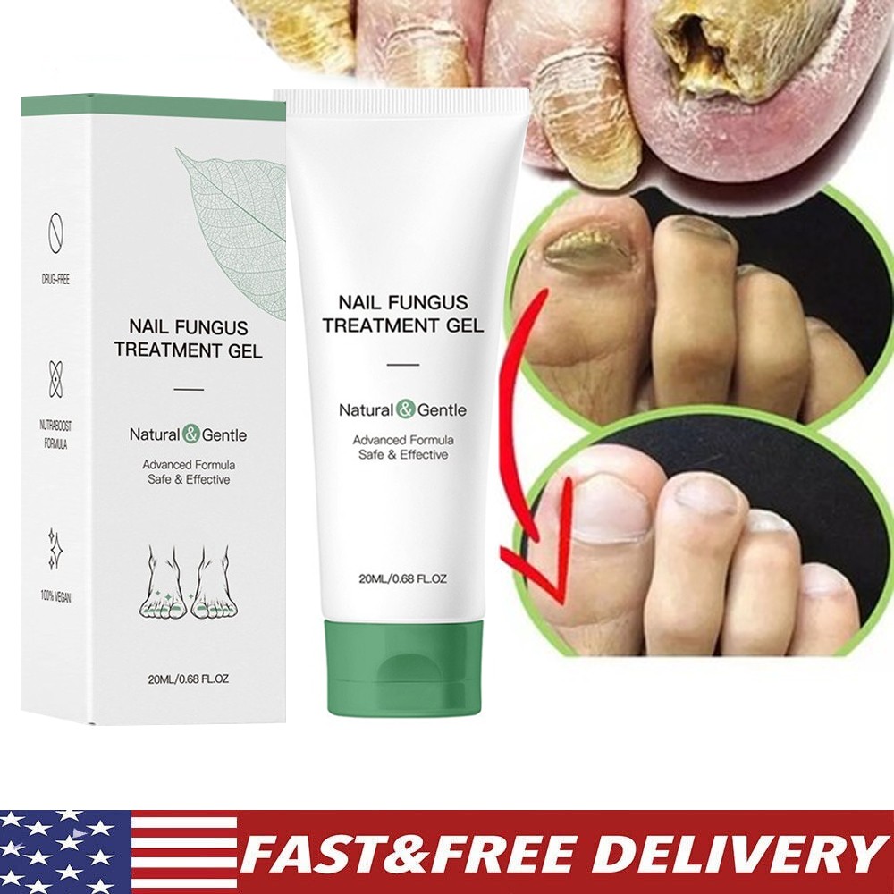 Nutraboost Nail Fungus Treatment Gel, Nail Fungus, Fungus Cream