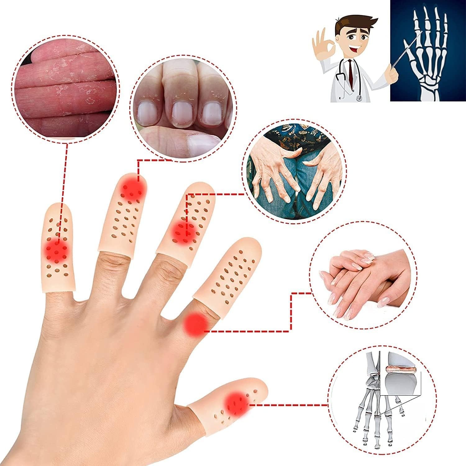 Customizable Silicone Finger Cots – 12 Pack to Relieve Pain from Eczema & More