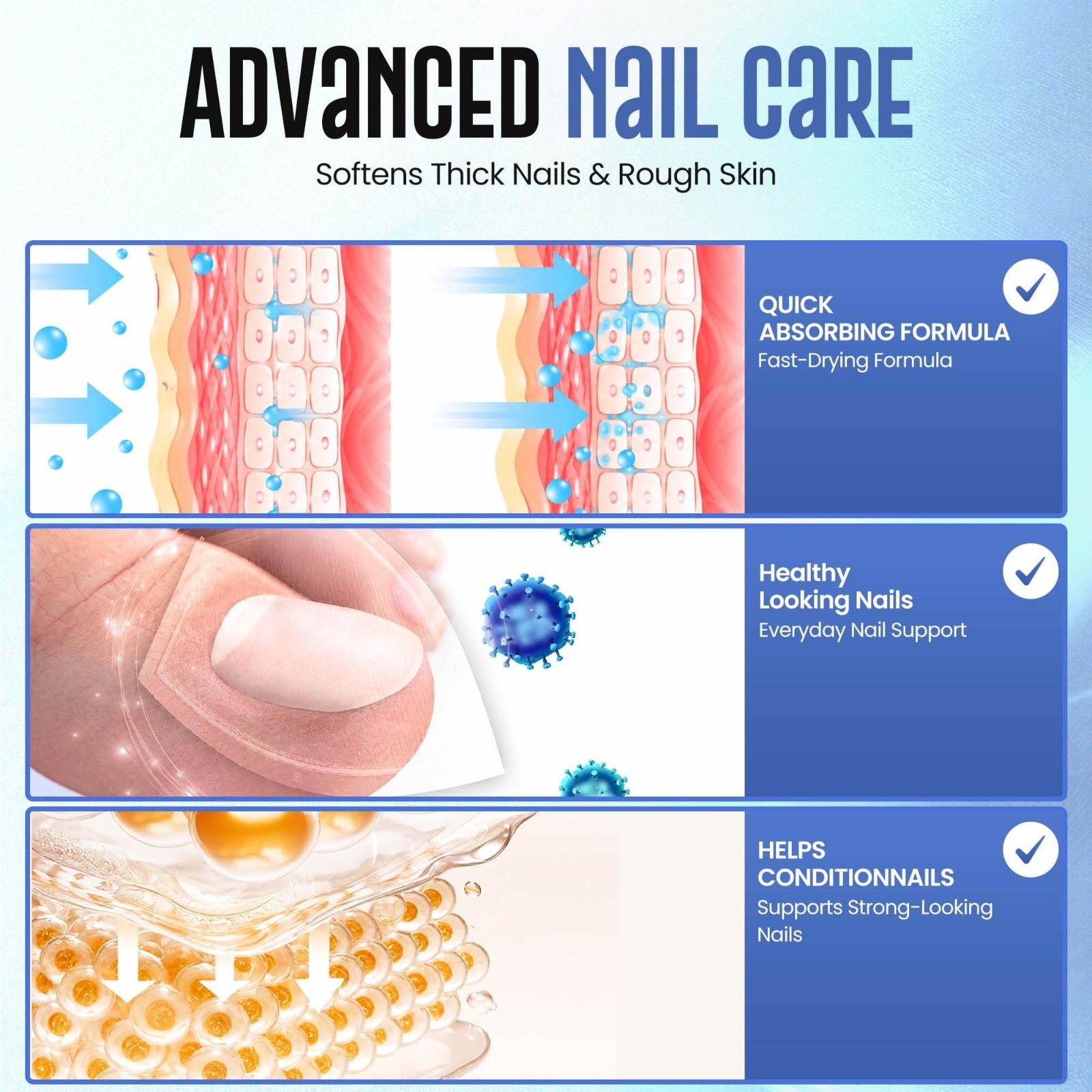50% Urea Nail Gel for Thick Toenails & Calluses – Softens, Exfoliates, Quick-Dry