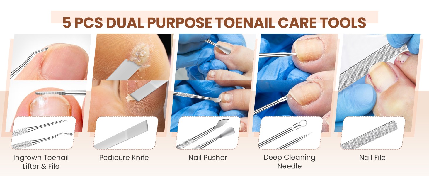 Ingrown Toenail Removal Kit: 8 Pcs Professional Toenail Clippers for Thick