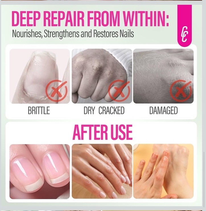 Nail Growth and Strengthening Serum for 0.51 Fl Oz (Pack of 2) Honey Milk