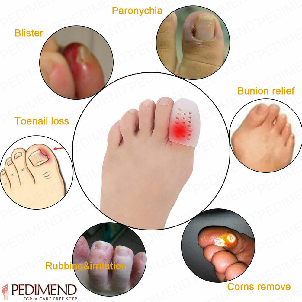 Toe Cover Caps To Prevent Ingrown Toenail, Blisters, Calluses Bunion Protector