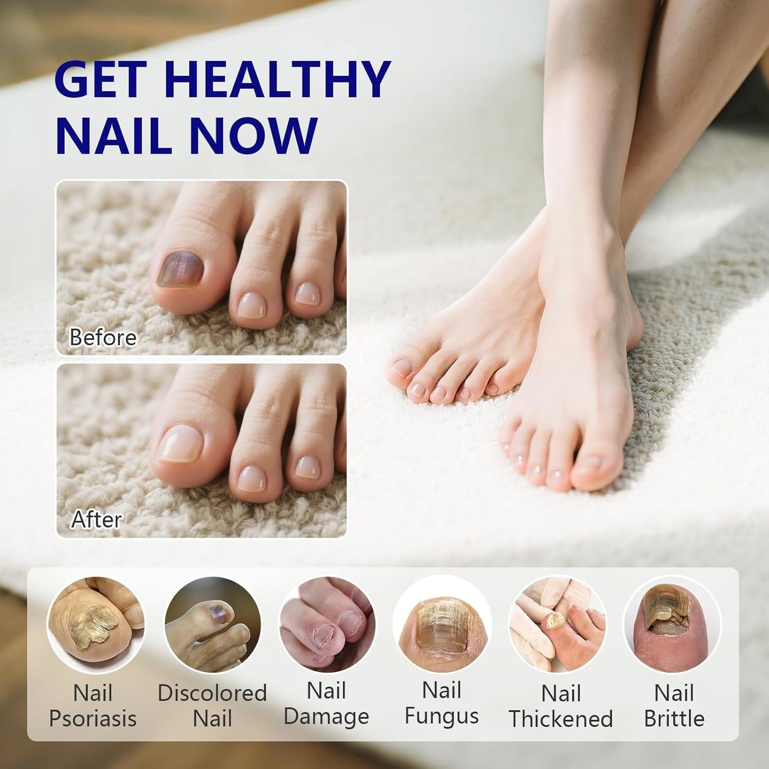 4x Nail Fungus Treatment Pen Extra Strength Acid for Toe & Finger Nail Repair US