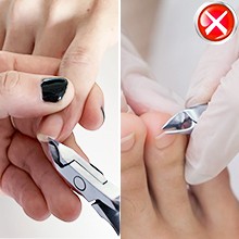 Cuticle Nippers Sn Grade for Manicurist Extremely Effortl