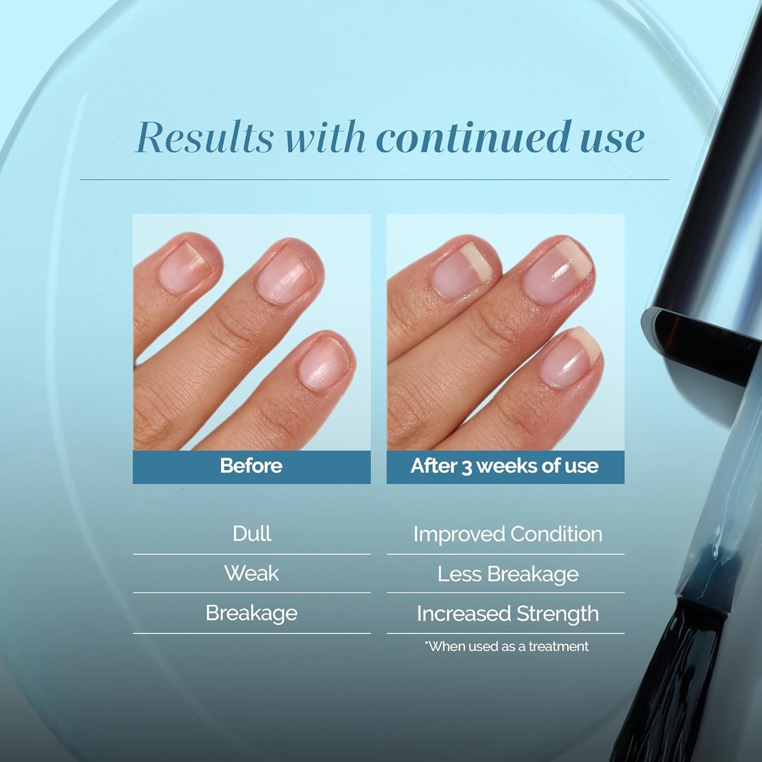 Luxury Nail Treatment – Strength and Growth Support for Weak, Brittle Nails
