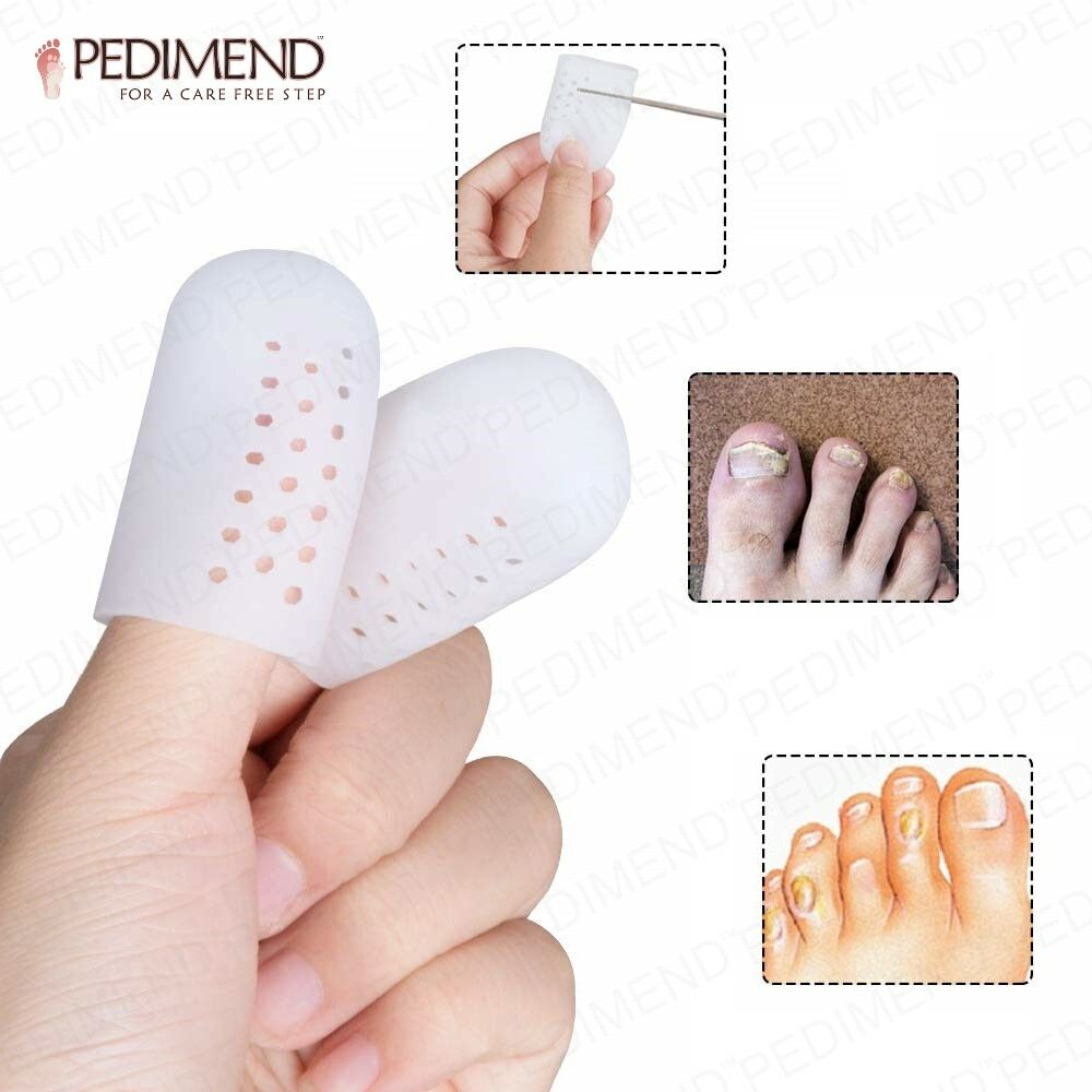 Toe Cover Caps To Prevent Ingrown Toenail, Blisters, Calluses Bunion Protector