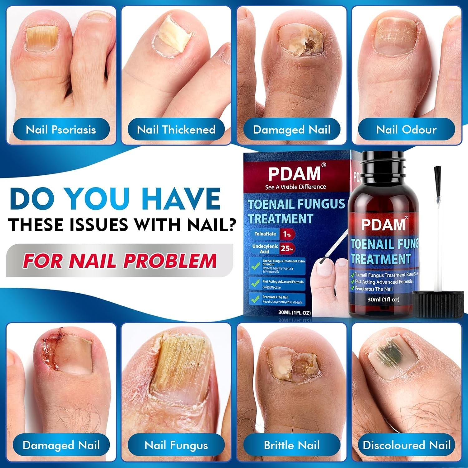PDAM Toenail Fungus Treatment Extra Strength 1 Fl Oz/30ml 7 DAYS REMEDY Fast-Act