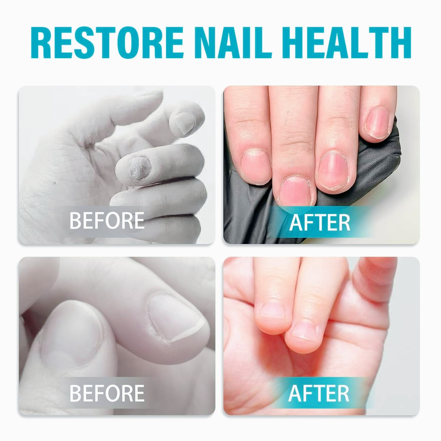 No Bite Nail Polish for Kids Adults Bitter Solution Thumb Sucking