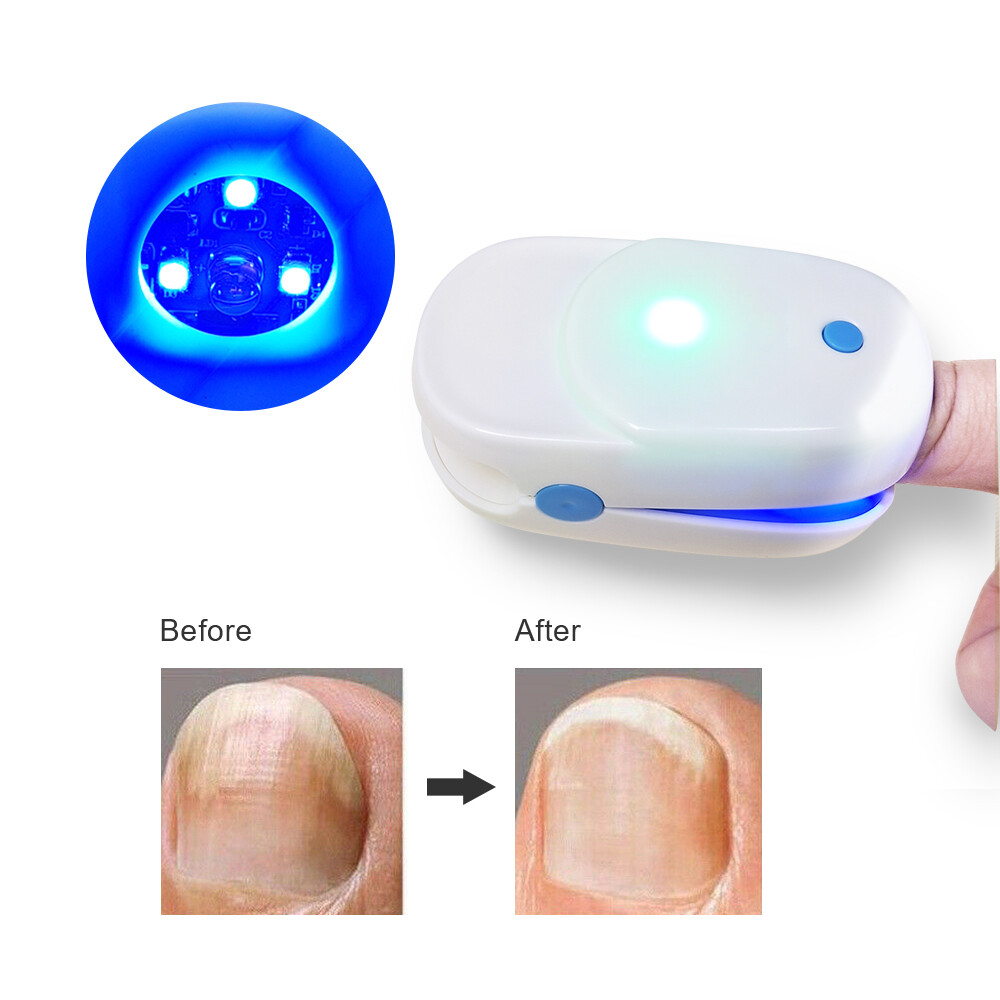 Fungal Nail Treatment Toenail Fungus Laser Device Anti Nail Fungal Infection US