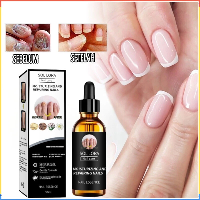 SOLLORA Nail essence Gray nail repair solution Nail Fungus beautify nails