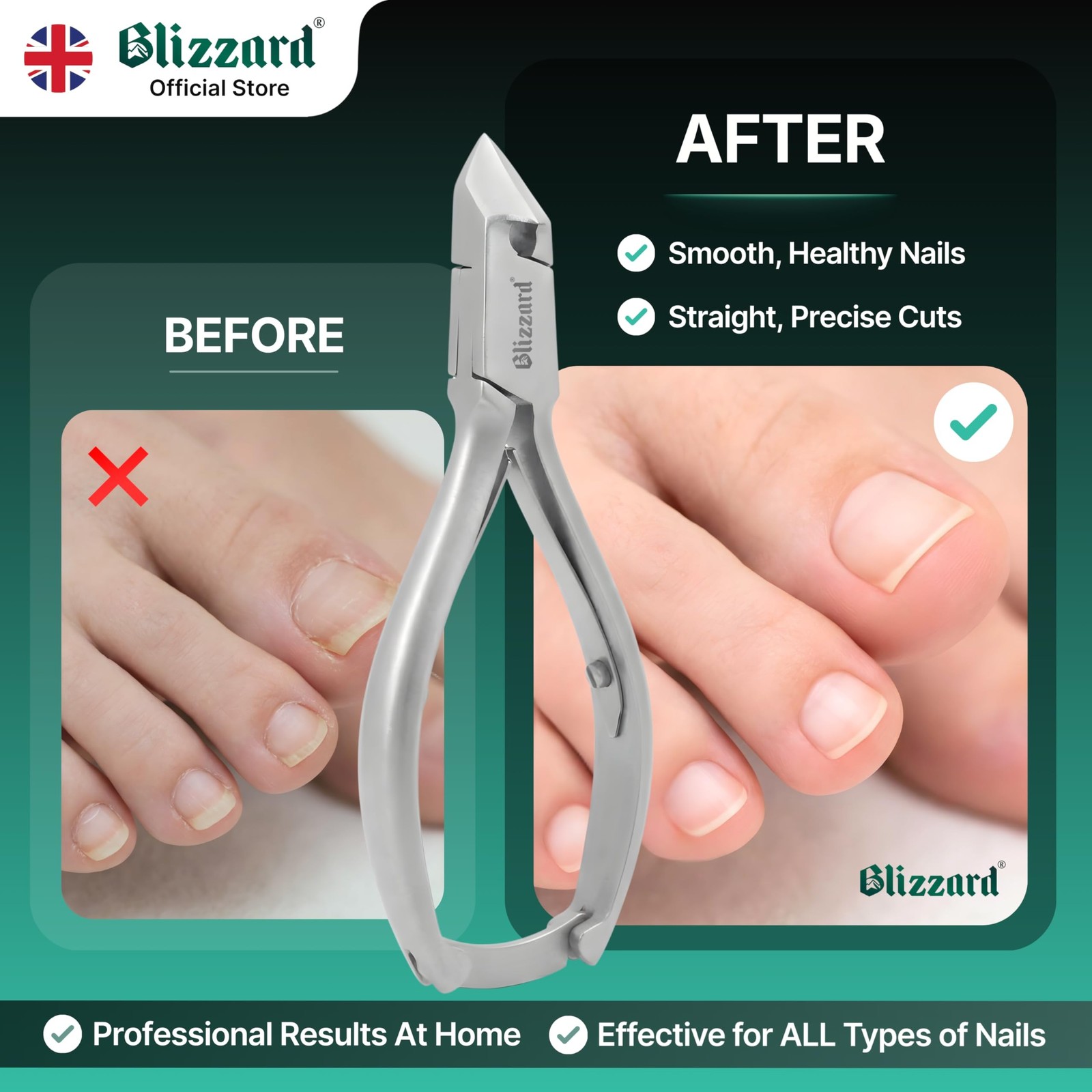 Nail Clippers for Men with Thick or Ingrown Toenails – Blizzard Podiatrist