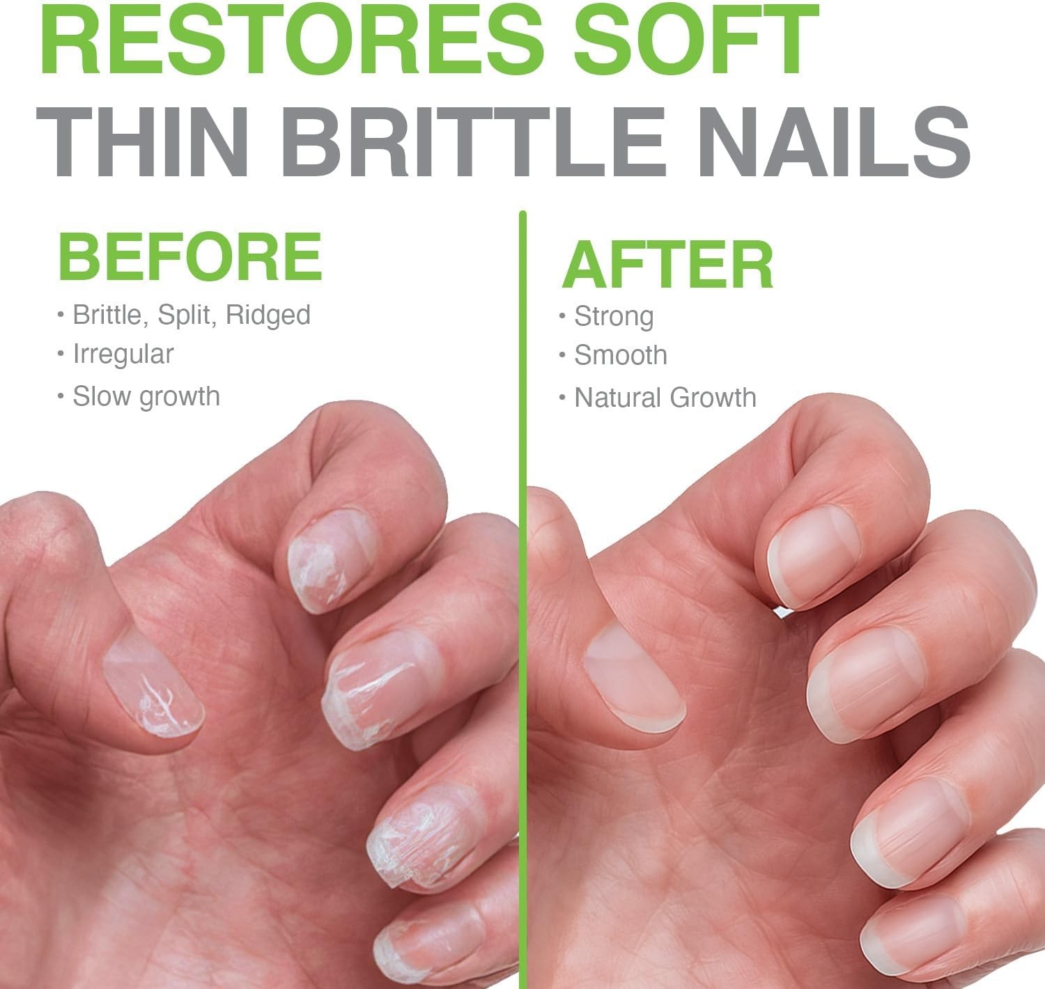 Probelle Nail Hardener Formula 1 – Repair Damaged Nails, Extra Strong Nail Growt