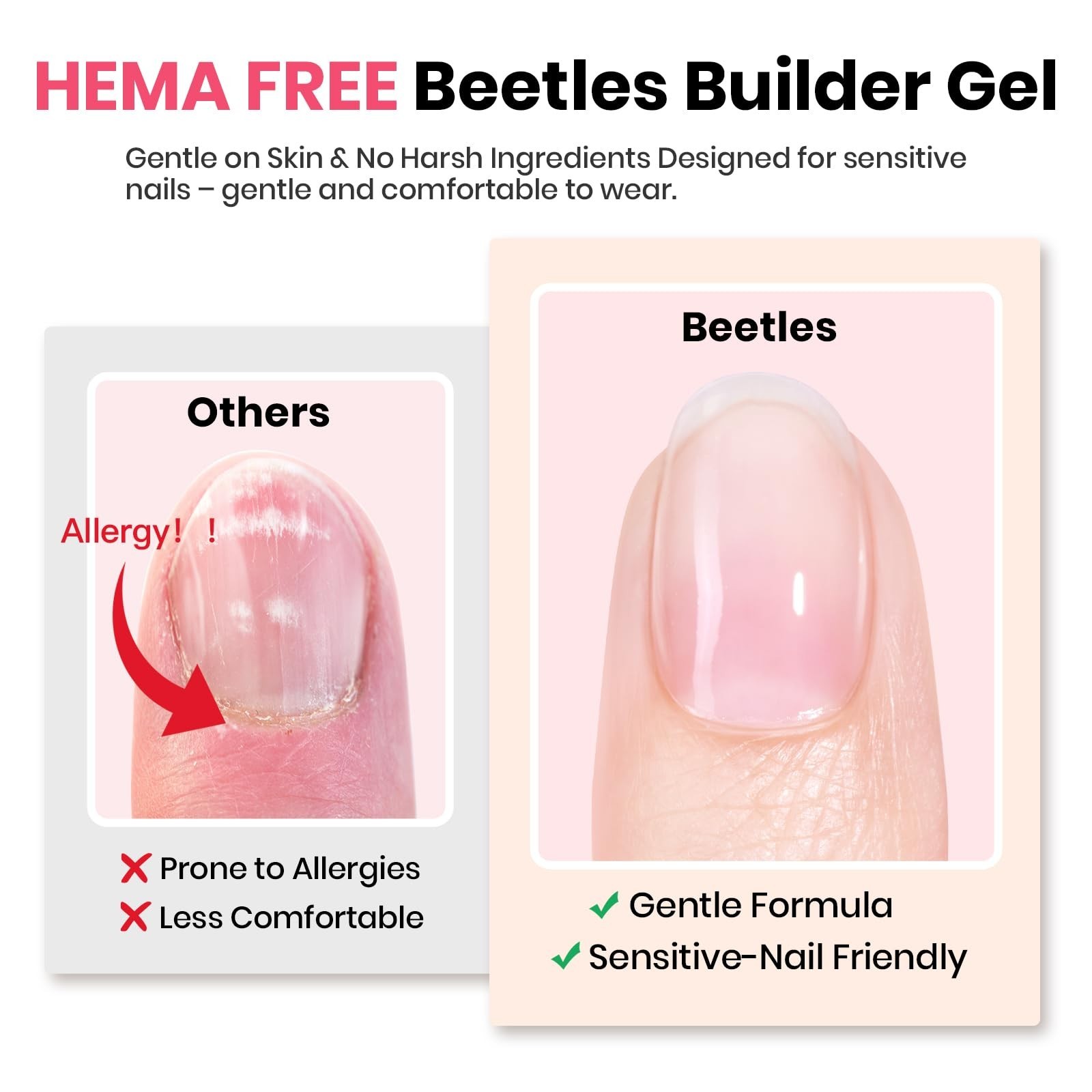 Nude Builder Gel Set – 4 Colors, HEMA Free, Base & Top Coat, Thickening Apex for