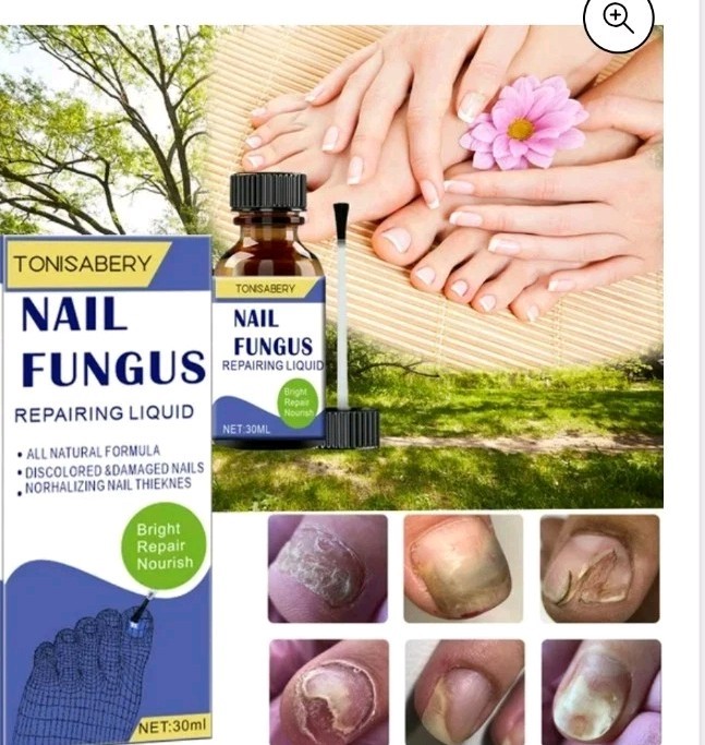 Nail Fungus Treatment For Toe and Finger Nails 30 ml