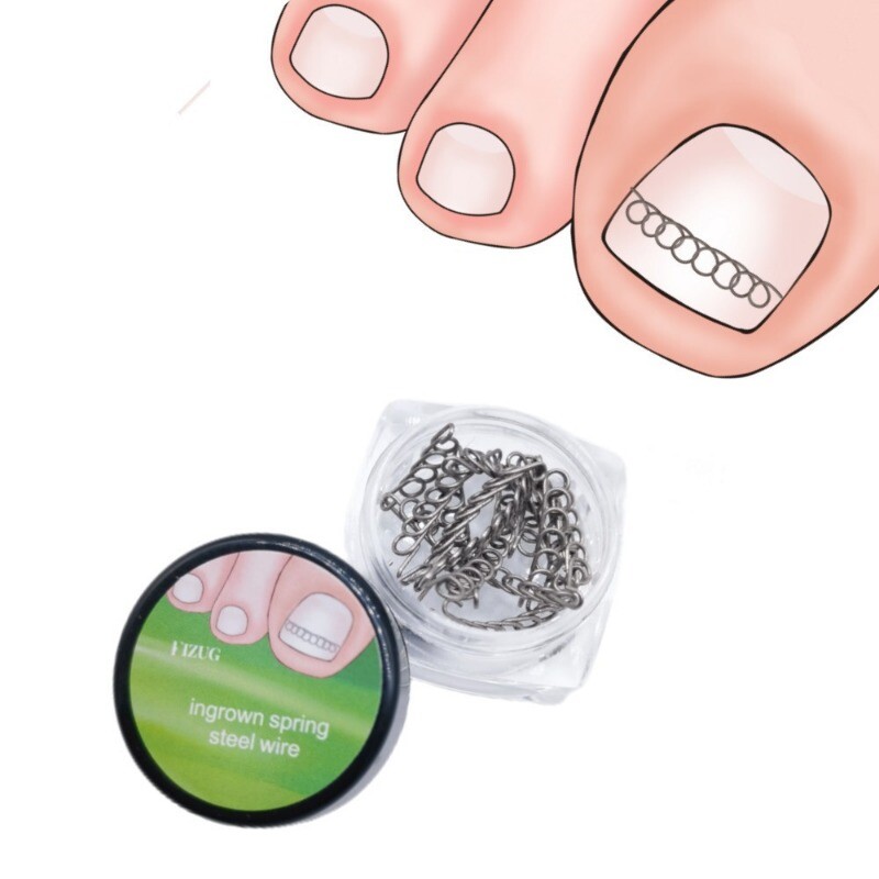 Toenail Correction Tool 12pcs/set Ingrown Toe Nail Fixer Pedicure 2024 NEW